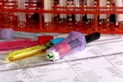 Новости  - Дизентерия обнаружена у 16 детей и 13 сотрудников Дербышкинского интерната