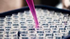 На сегодняшний день зафиксировано 8 945 заболевших новой коронавирусной инфекцией